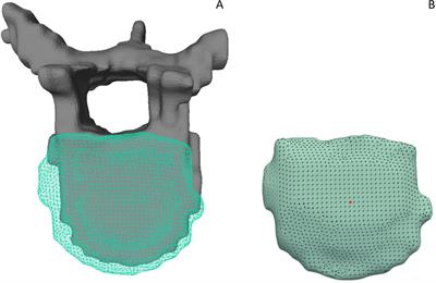 From MRI to FEM: an automated pipeline for biomechanical simulations of vertebrae and intervertebral discs